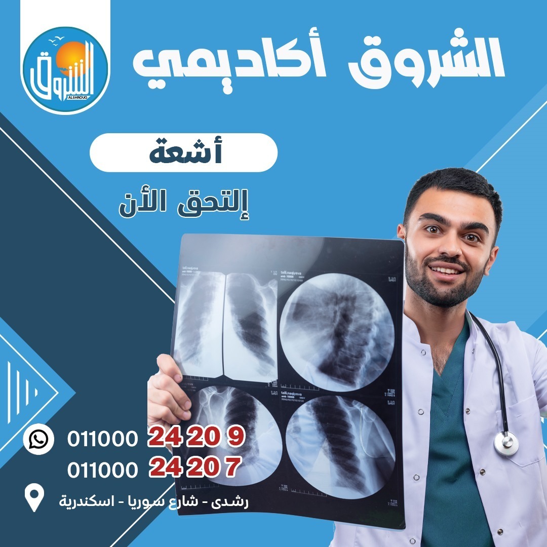 أشعة